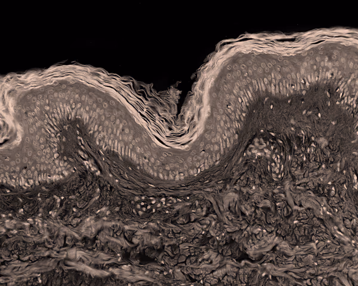 A micrograph of the gut lining